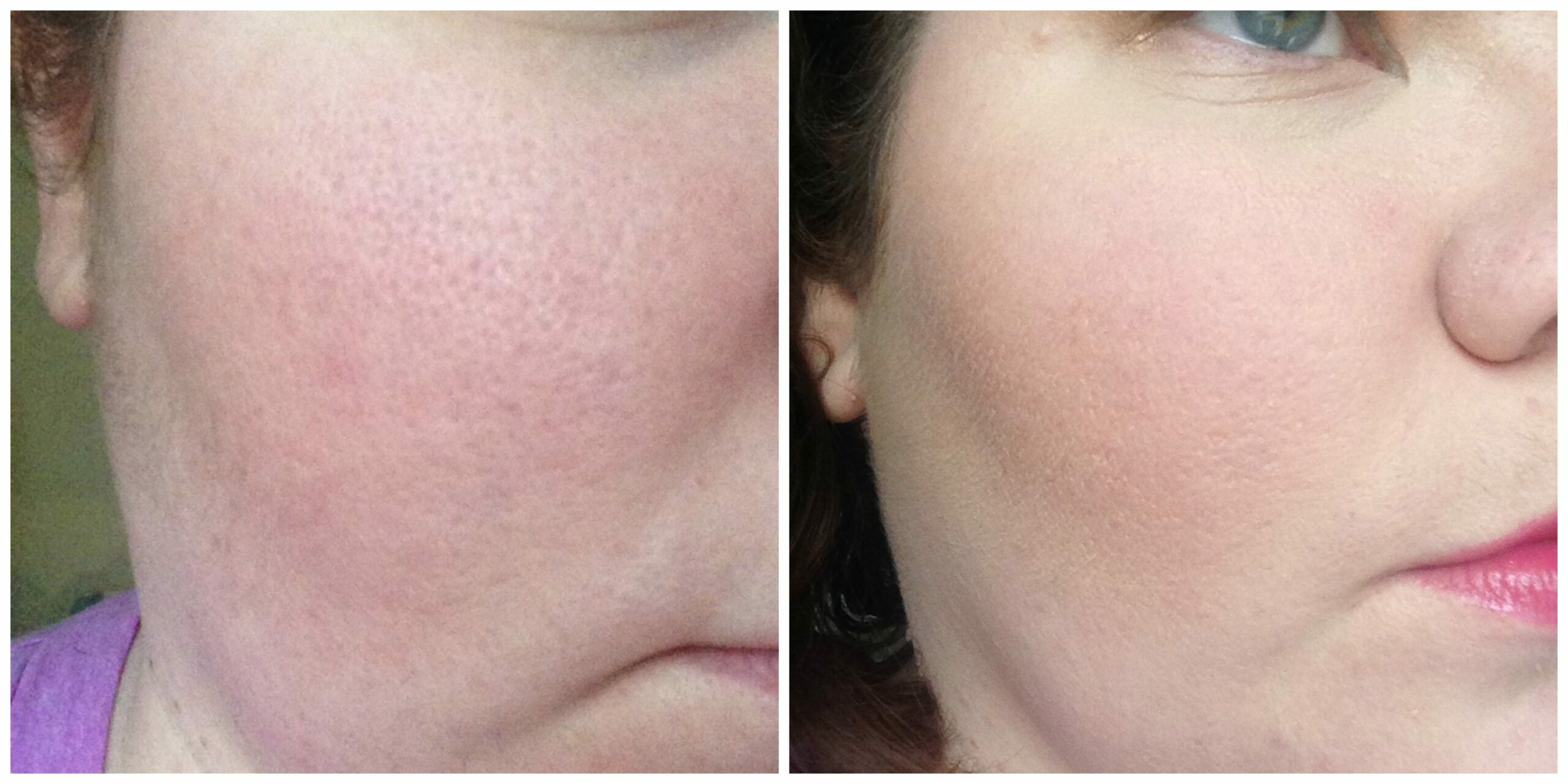 Left (Before with no makeup) and Right (After with Mally poreless defender) I'm wearing NO PRIMER to help with my pores.